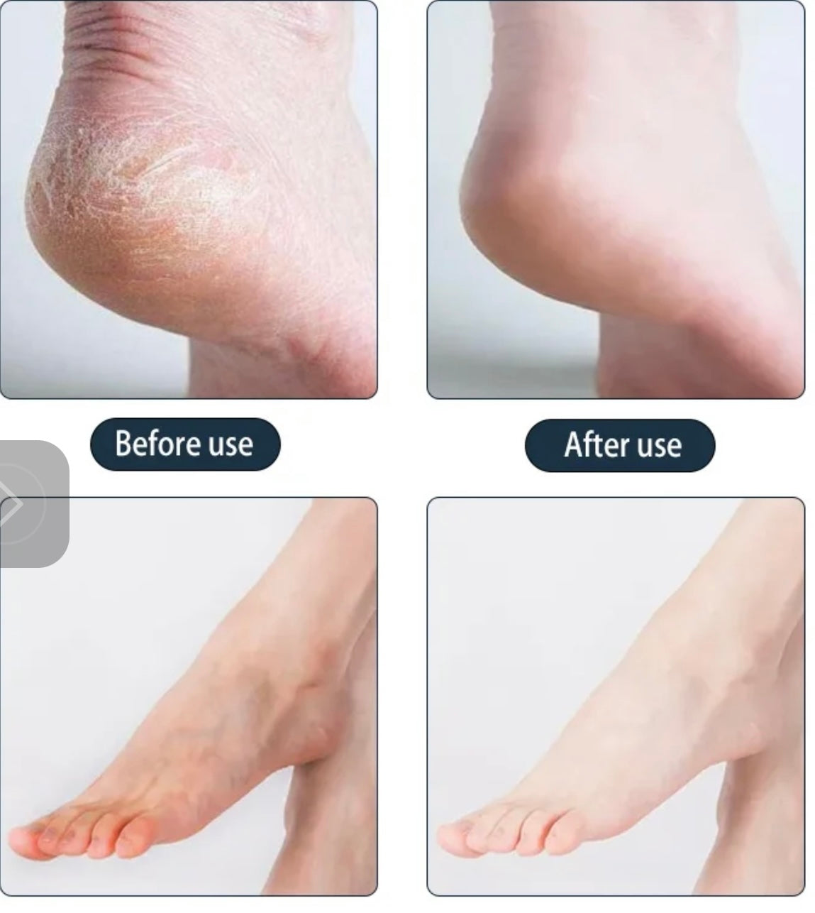 Exfoliating Foot mask