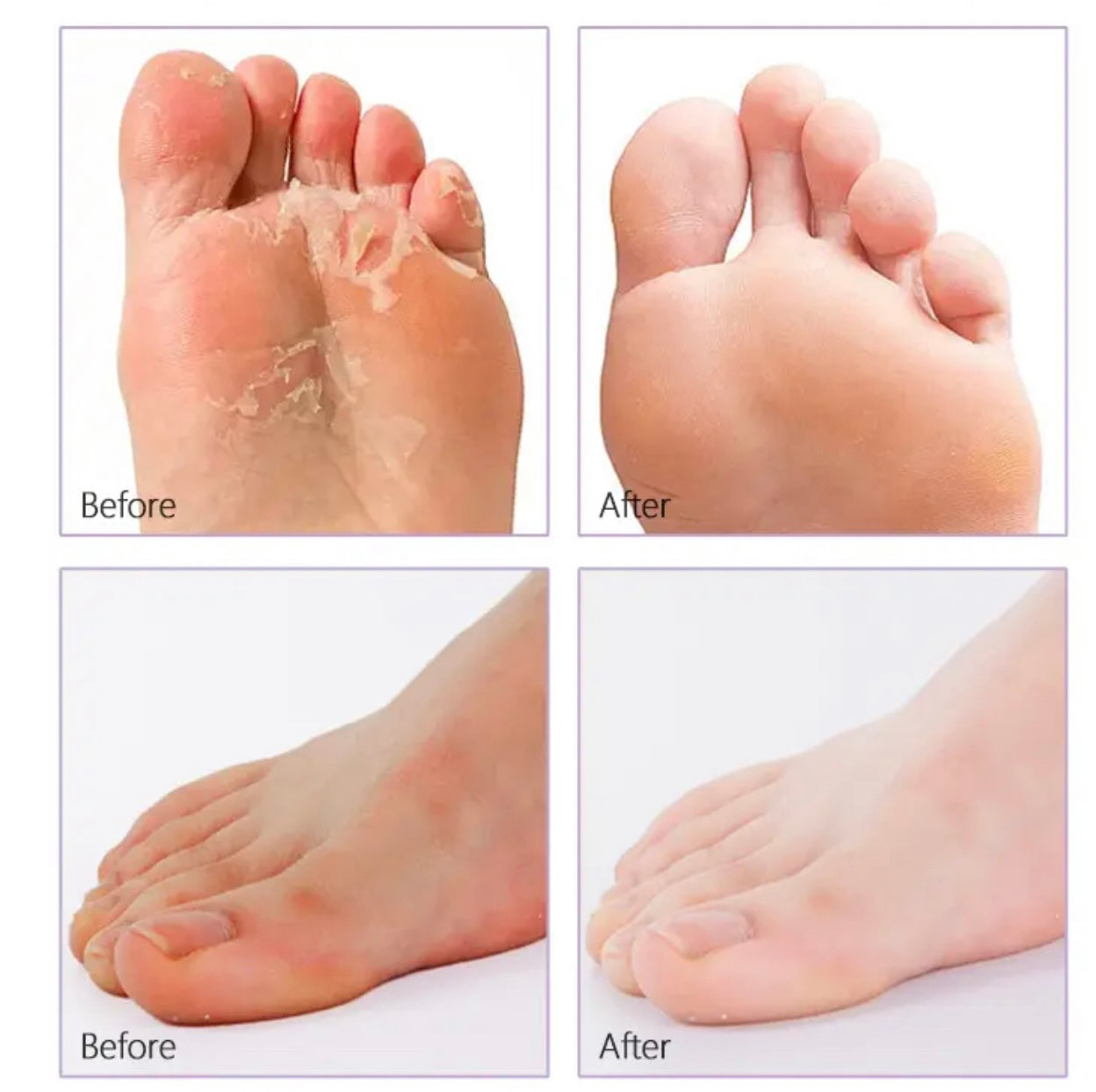 Exfoliating Foot mask